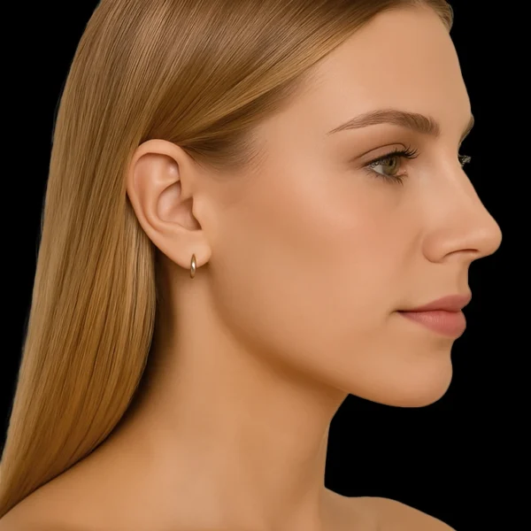 MG Beauty Clinc - Filler Naso Rinofller Dopo