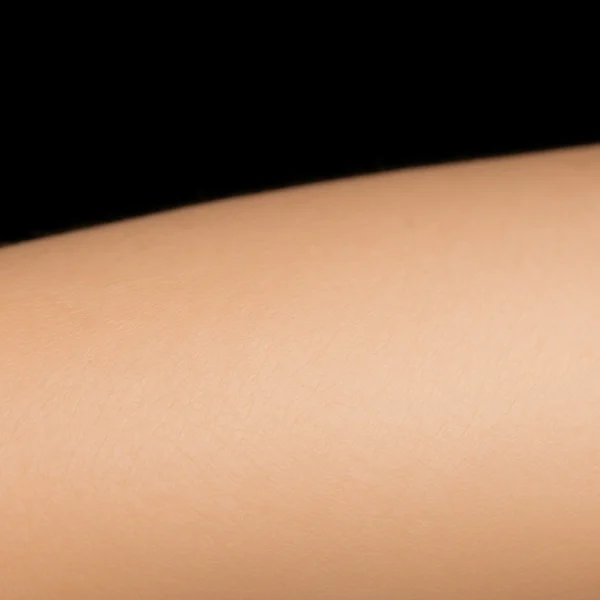 MG Beauty Clinic - Patologie Angiomi Rubino dopo