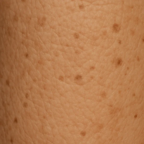 MG Beauty Clinic - Patologie Dermatofunzionali Invecchiamento Cutaneo (3)