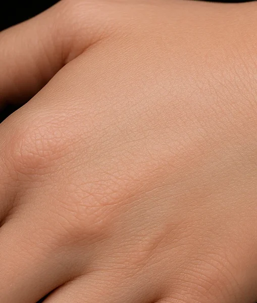 MG Beauty Clinic - Patologie Molluschi Contagiosi dopo