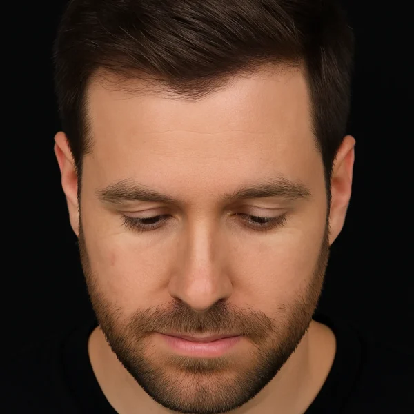 MG Beauty Clinic - Trattamenti Tricologici Trapianto FUT dopo