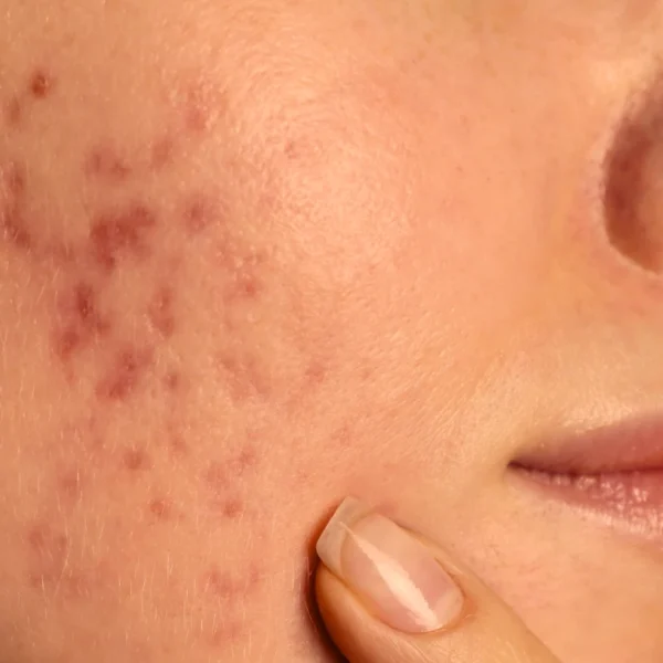 MG Beauty Clinic - VisitaSpecialistica Dermatologia Focus