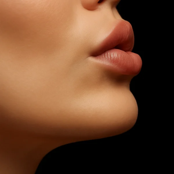 MG Beauty Clinic - Botox Lip Flip (3)